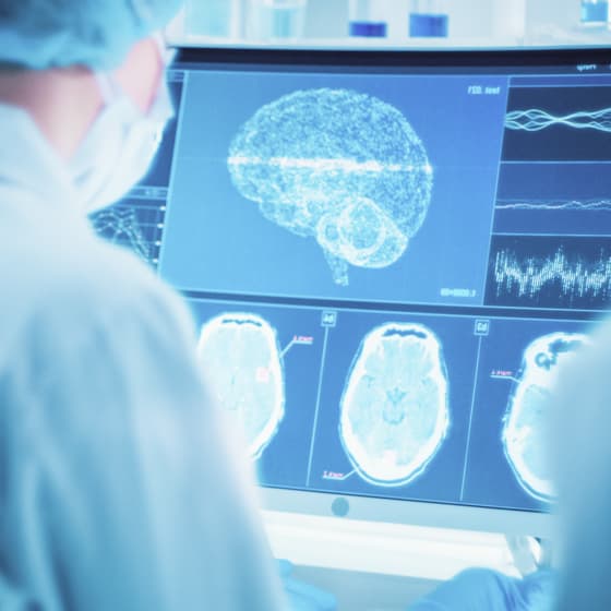 How Does Brain Fog Differ From Dementia?