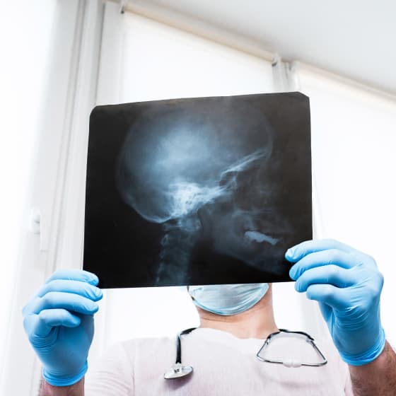 What Protects The Brain Against Parkinson’s Disease?