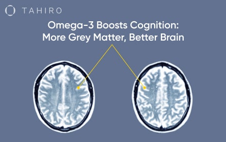 Benefits Of Omega 3 Fatty Acids Brain Development